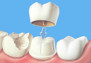 Dr. Marius Calinescu Florian - cabinet stomatologie